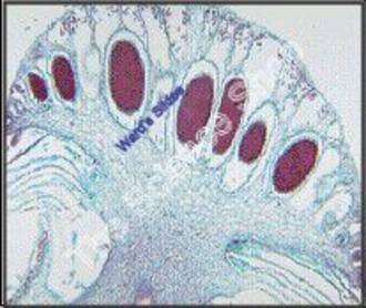 Marchantia Antheridia (ls) Shows antheridiophore chambers and general ...