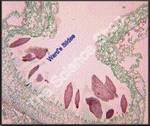 Marchantia Antheridia (ls) Shows antheridiophore chambers and general ...